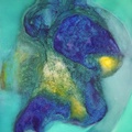 Metafigura 11