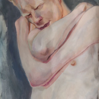 Albino Youth